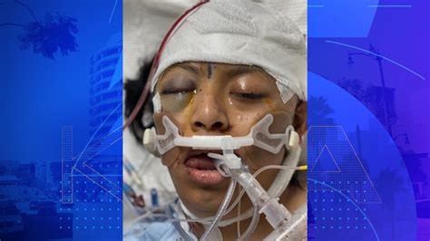 L.A. County hospital seeks help identifying hit-and-run patient
